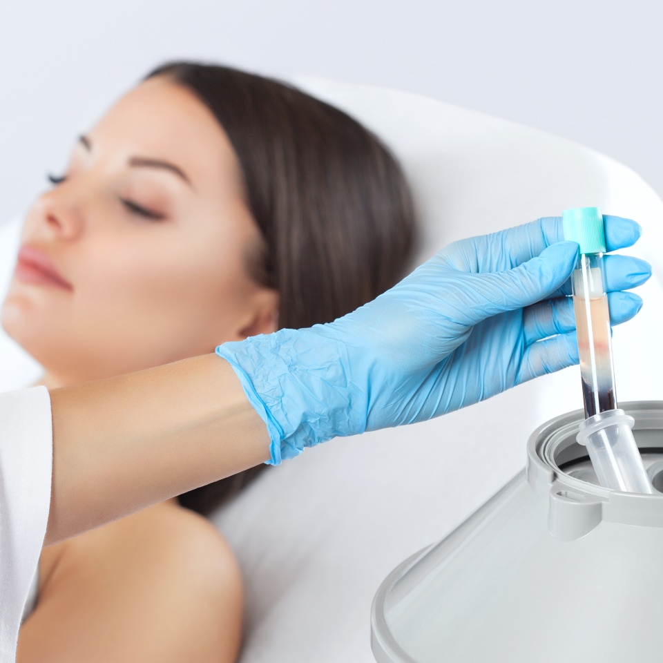 The blood tube is removed from the medical centrifuge for plasma lifting. Prp procedure. Cosmetology and skin care.