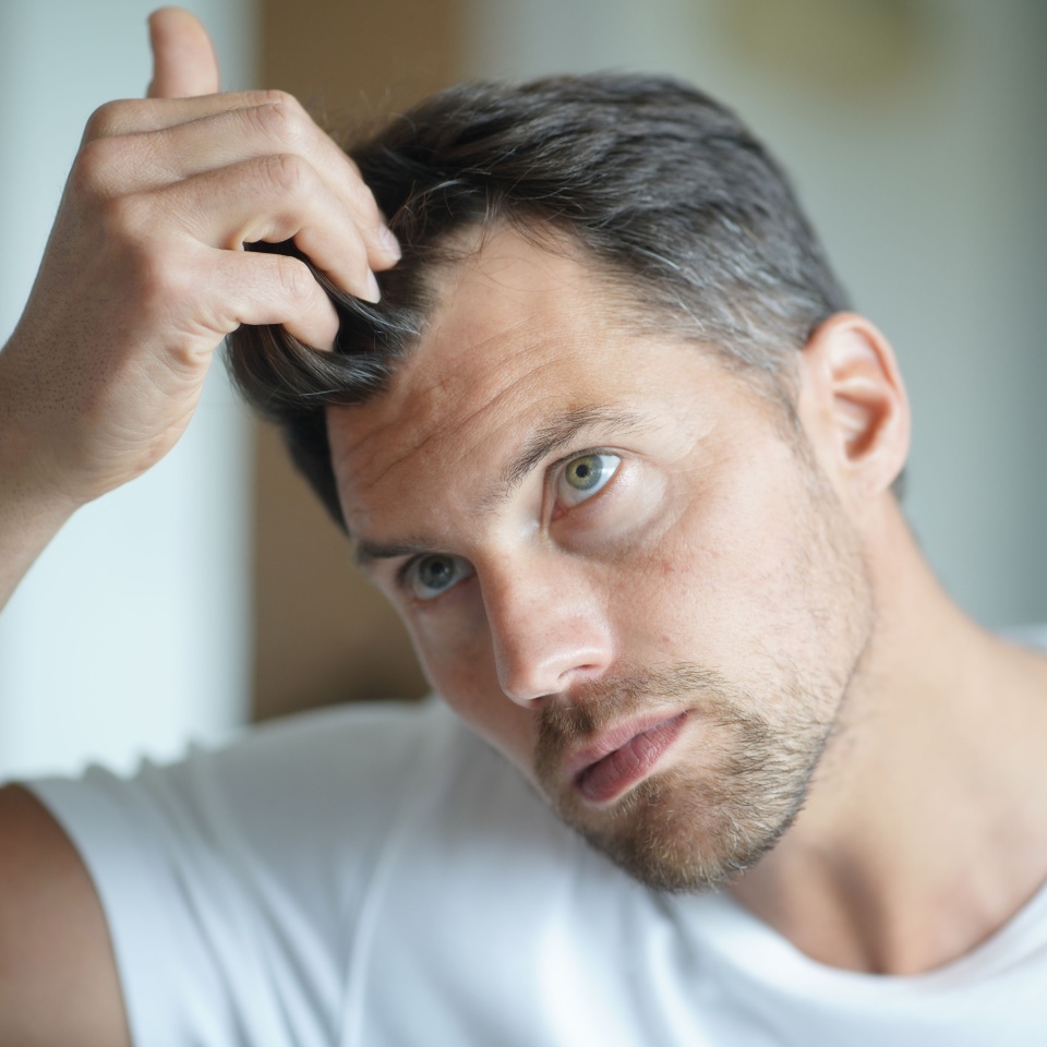 Portrait of a man worried about hair loss