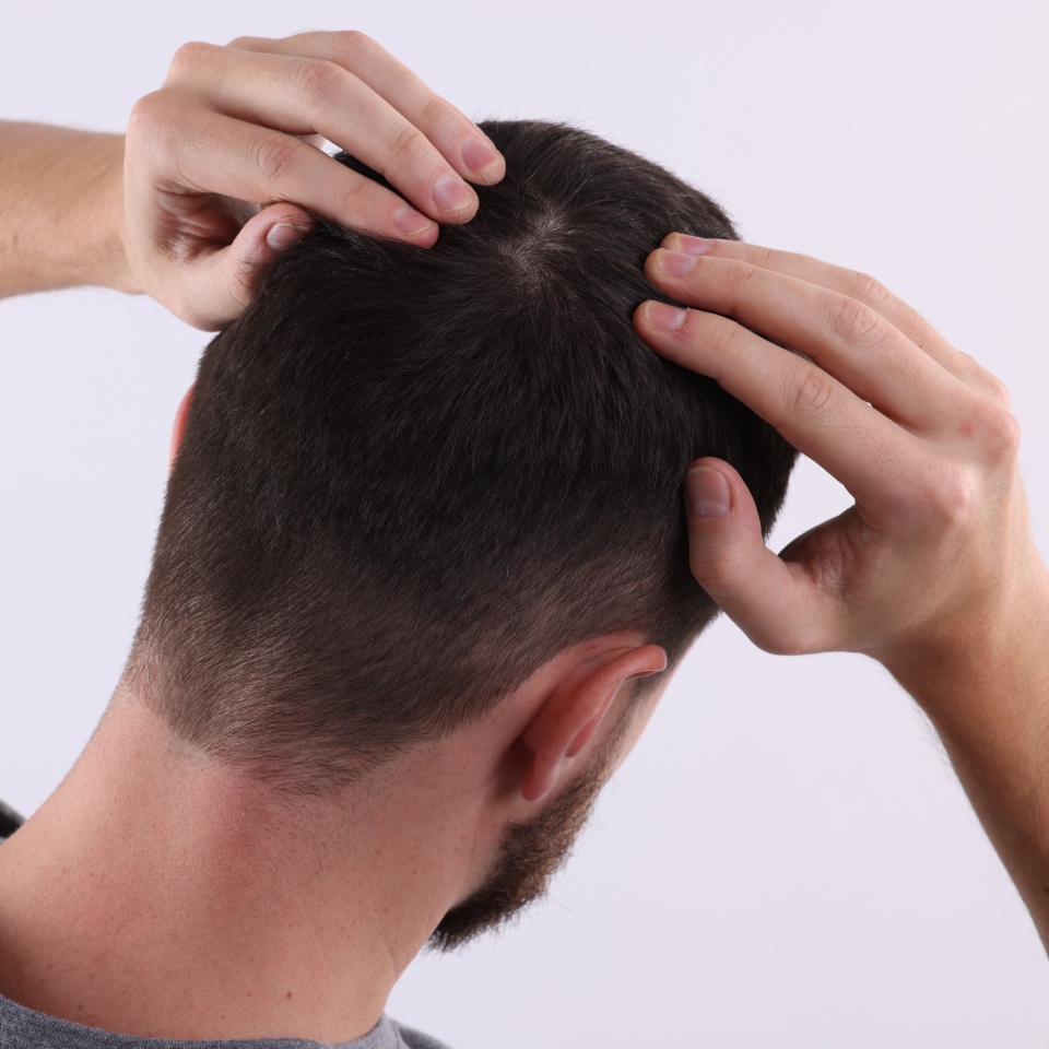 Man examining his hair and scalp on white background