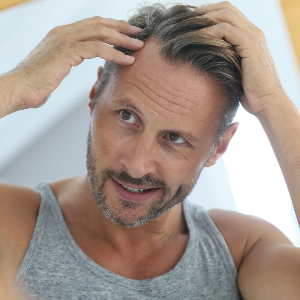 Middle-aged man concerned by hair loss